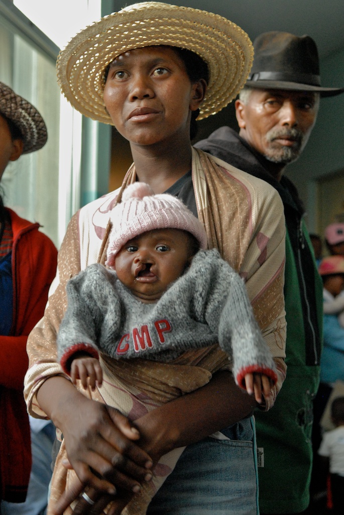 © anton crone - Mother and Child, awaiting surgery, Antananarivo