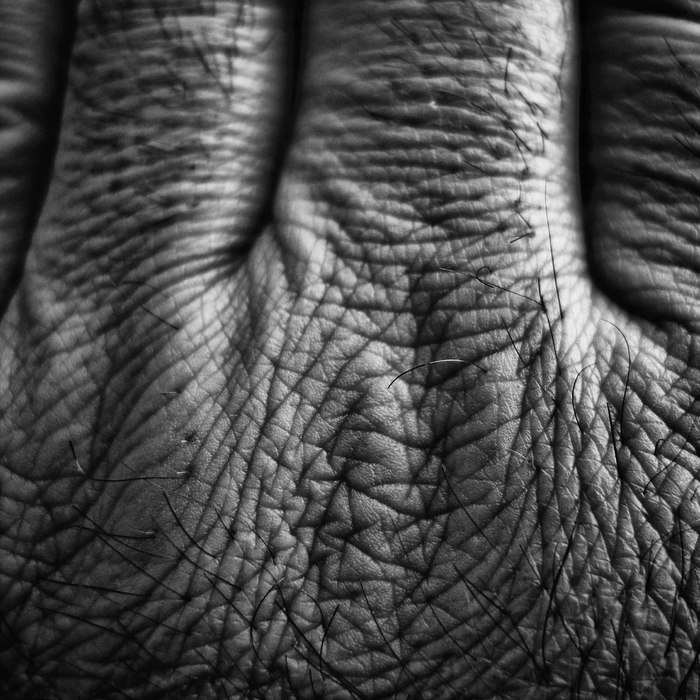 © Jean-Francois Dupuis - Hairy hand